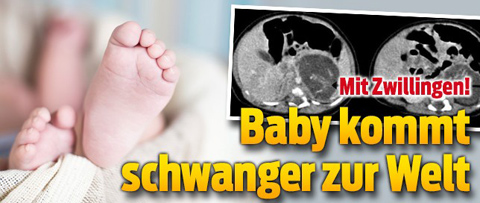 12---TT-3469198-Baby-kommt-schwanger-zur-Welt-